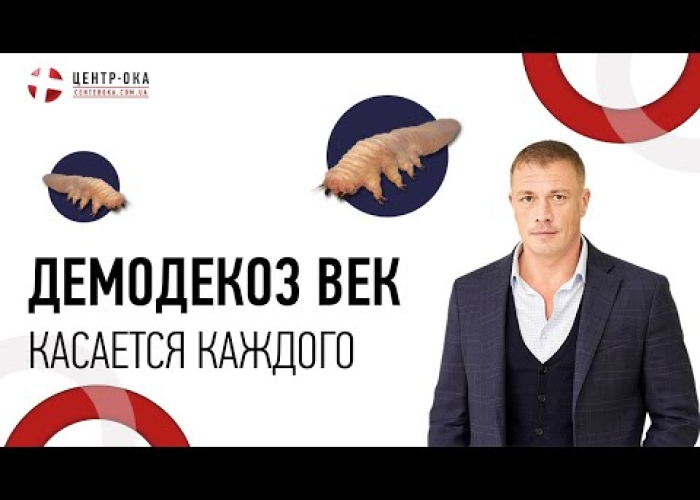 Демодекоз век