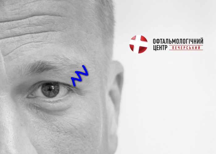 Чому сіпається око і що з цим робити?