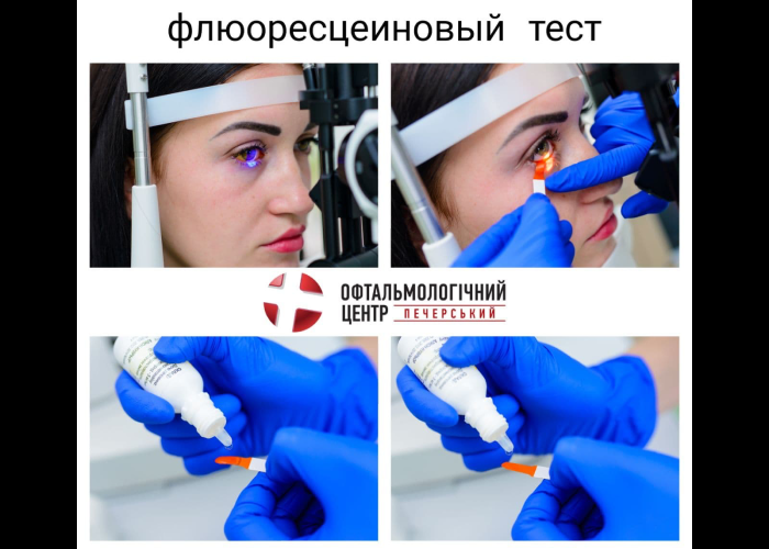 закрапувати в очі