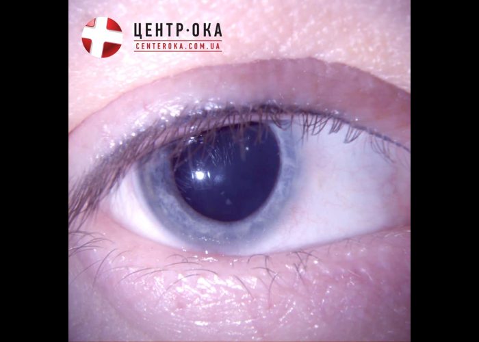 длинные ресницы